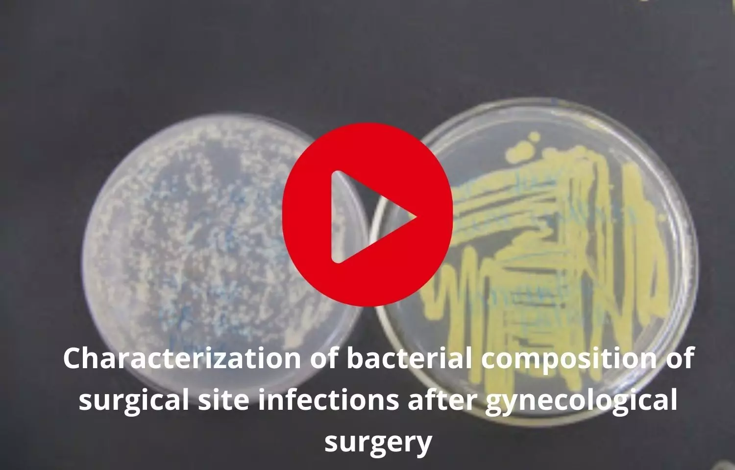 Bacterial composition of surgical site infections after gynecological surgery