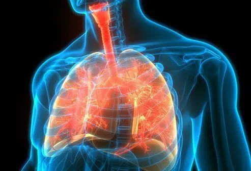 Higher BMI improves pulmonary function and lowers complications in Cystic fibrosis