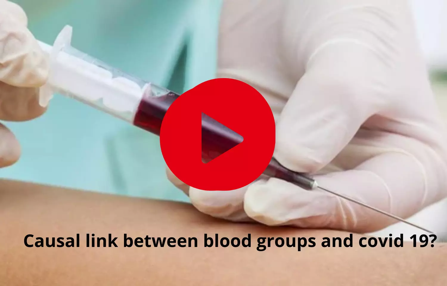 Causal link found between blood groups and covid 19?