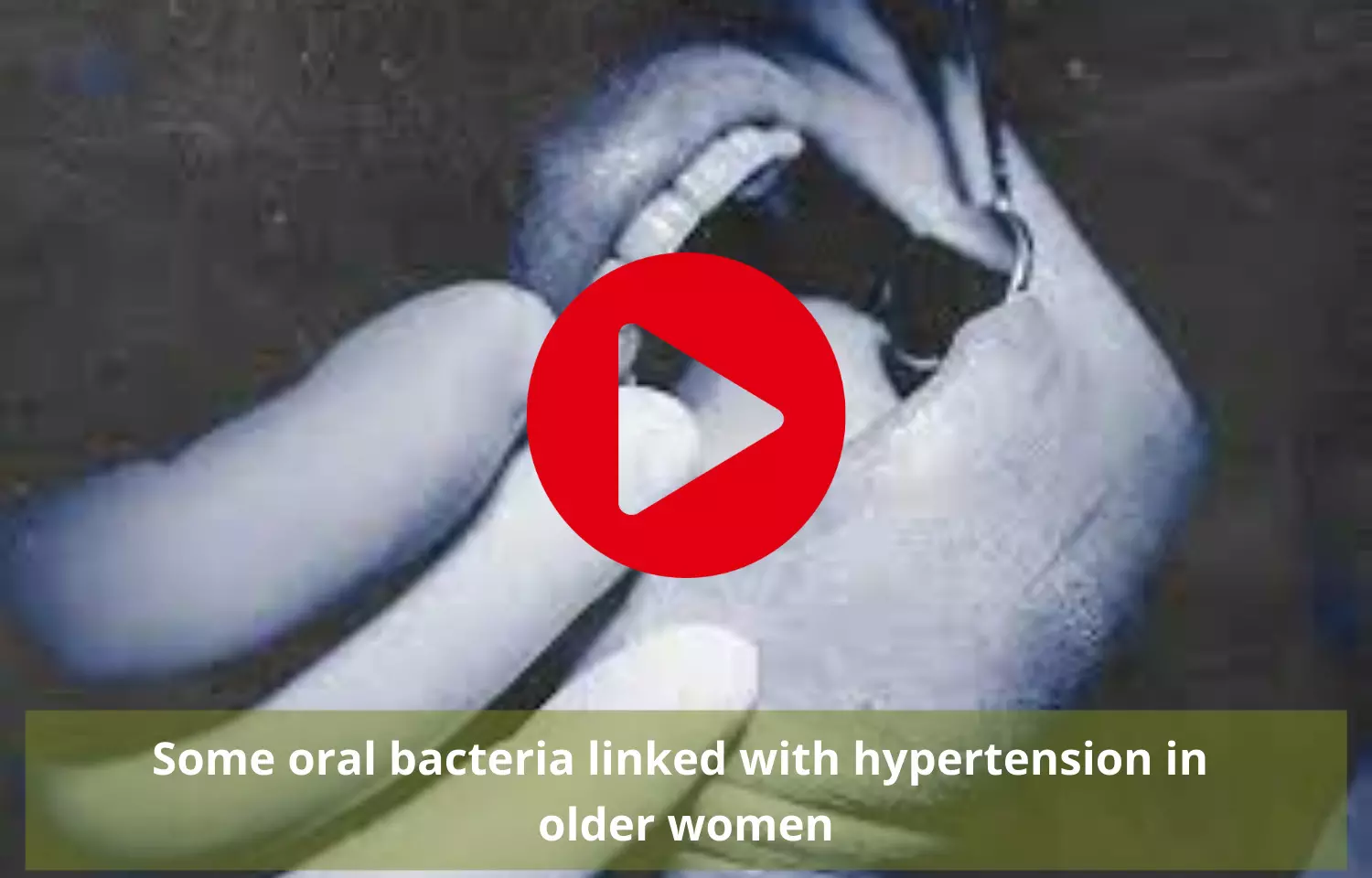 Few oral bacteria linked with hypertension in older women