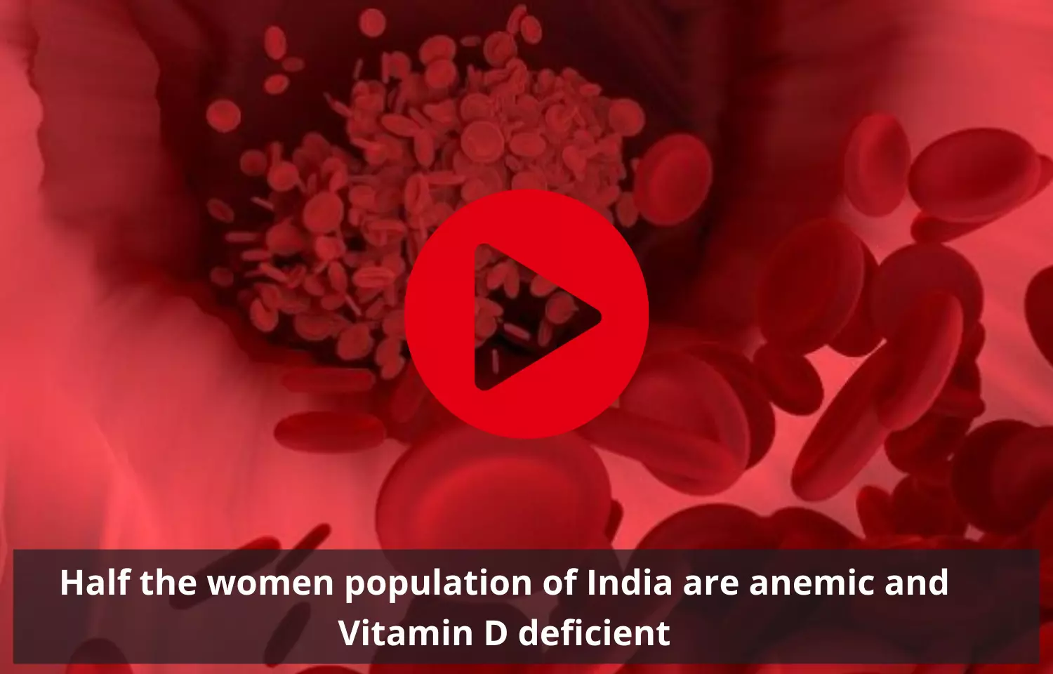 Half the women population of India are anemic and Vitamin D deficient