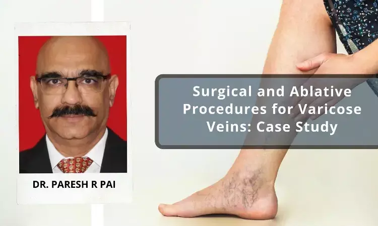Surgical and Ablative Procedures for Varicose Veins