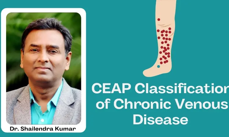 Understanding CEAP Classification