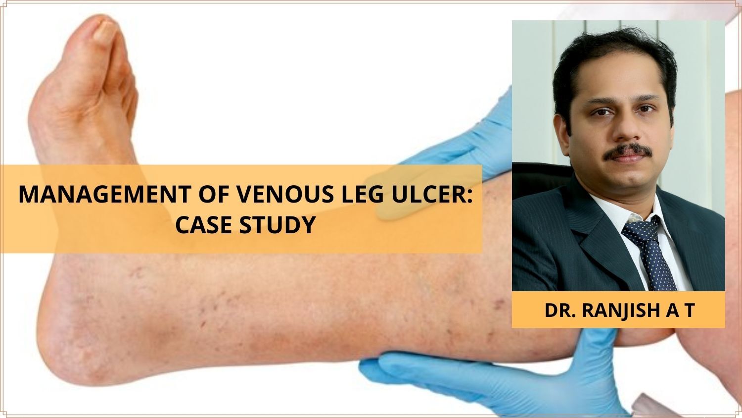 venous leg ulcer case study essay