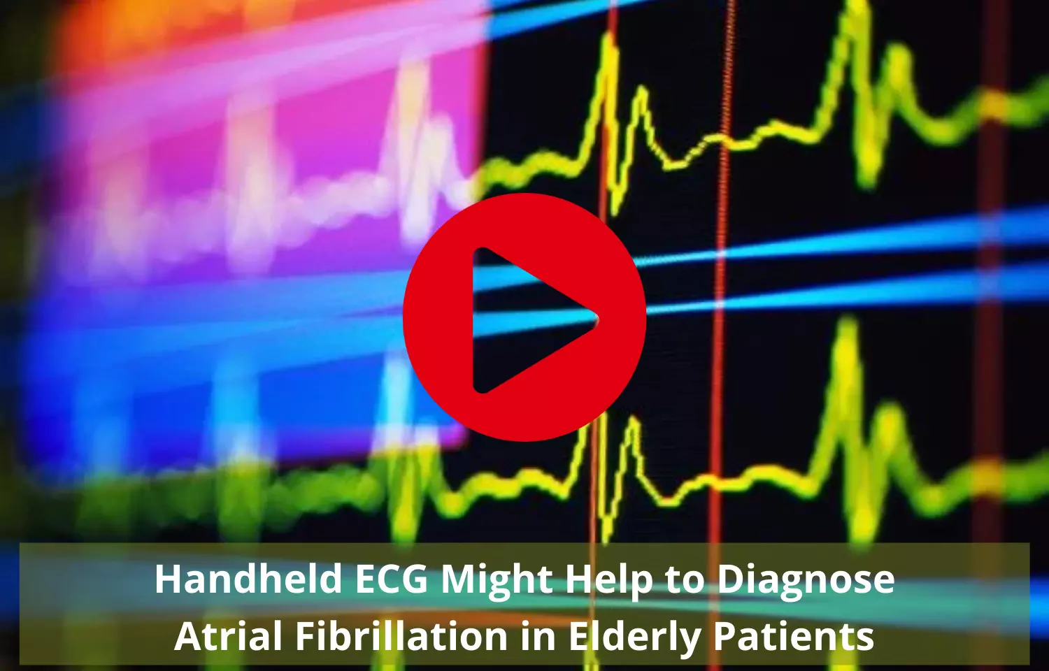 Handheld ECG Might Help to Diagnose Atrial Fibrillation in Elderly Patients