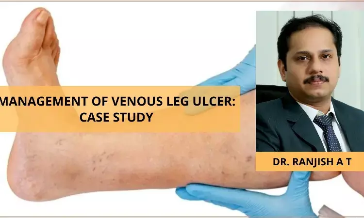 Management of Venous Leg Ulcer: Case Study