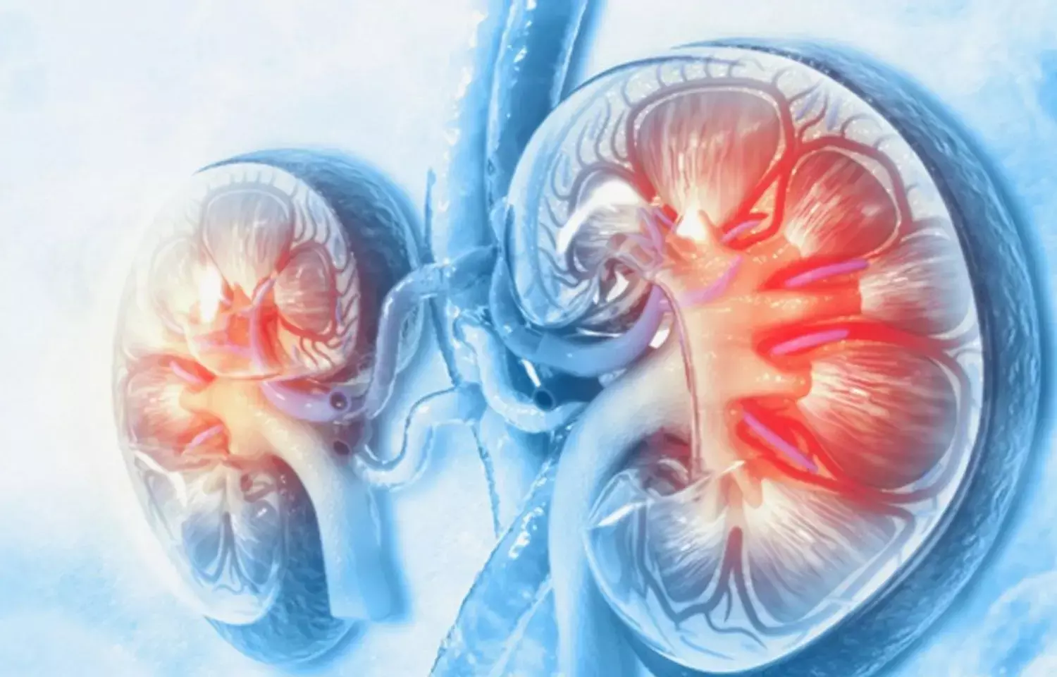 Increased risk of dementia in patients hospitalized for acute kidney injury