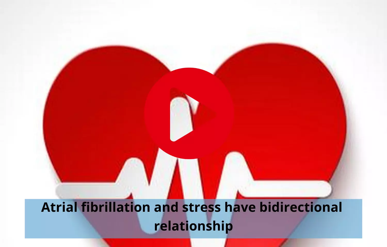 Atrial fibrillation and stress to have bidirectional relationship