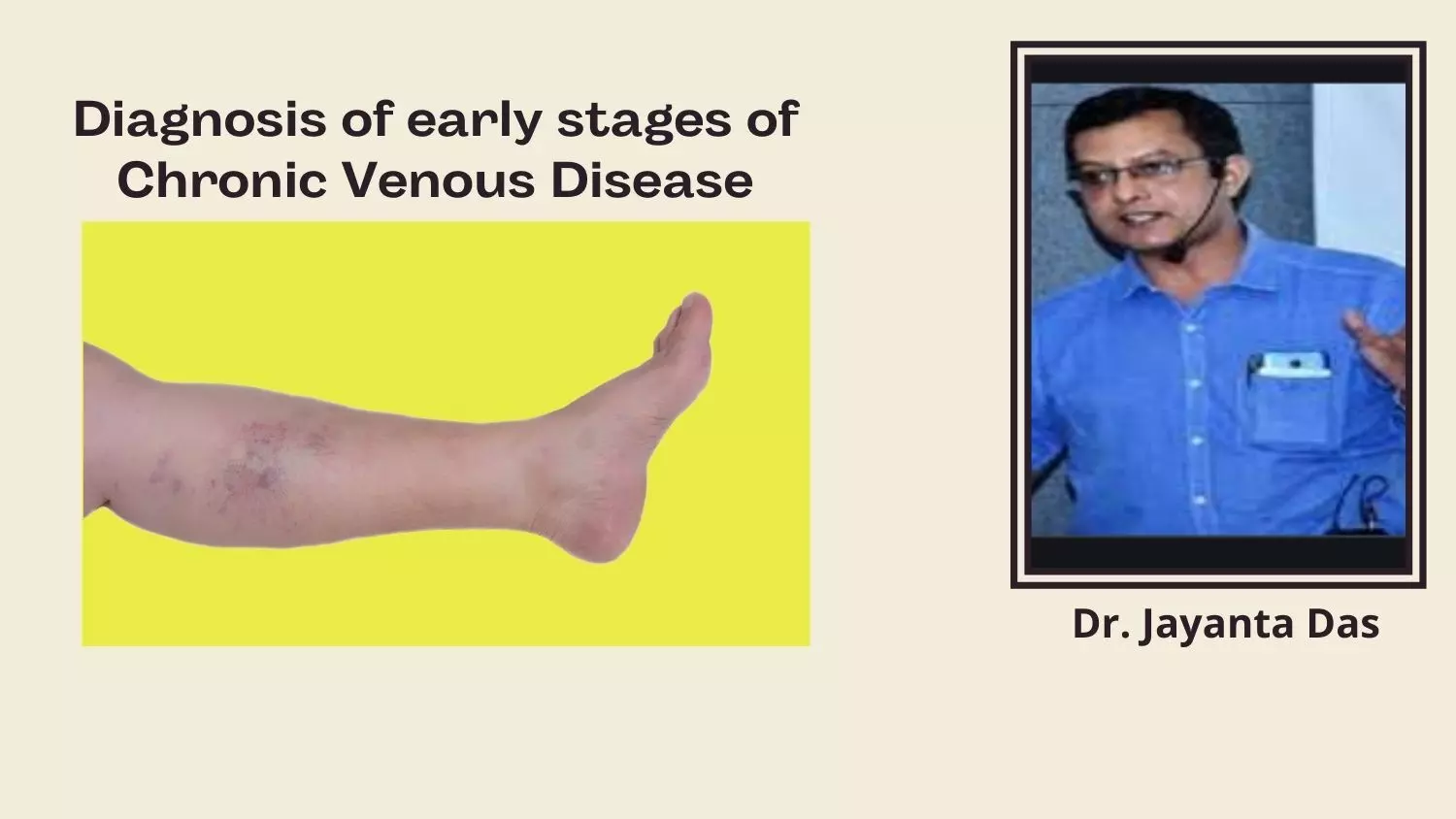 Screening and Diagnosis of early Stages of Chronic Venous Disease