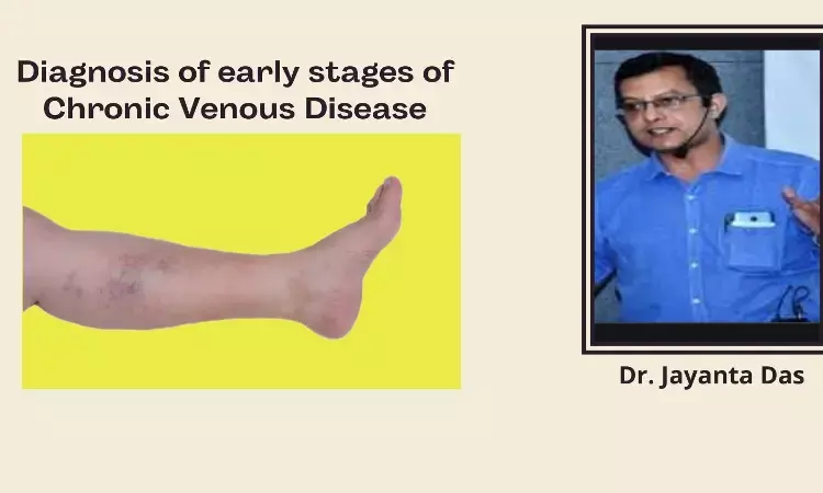 Screening and Diagnosis of early Stages of Chronic Venous Disease
