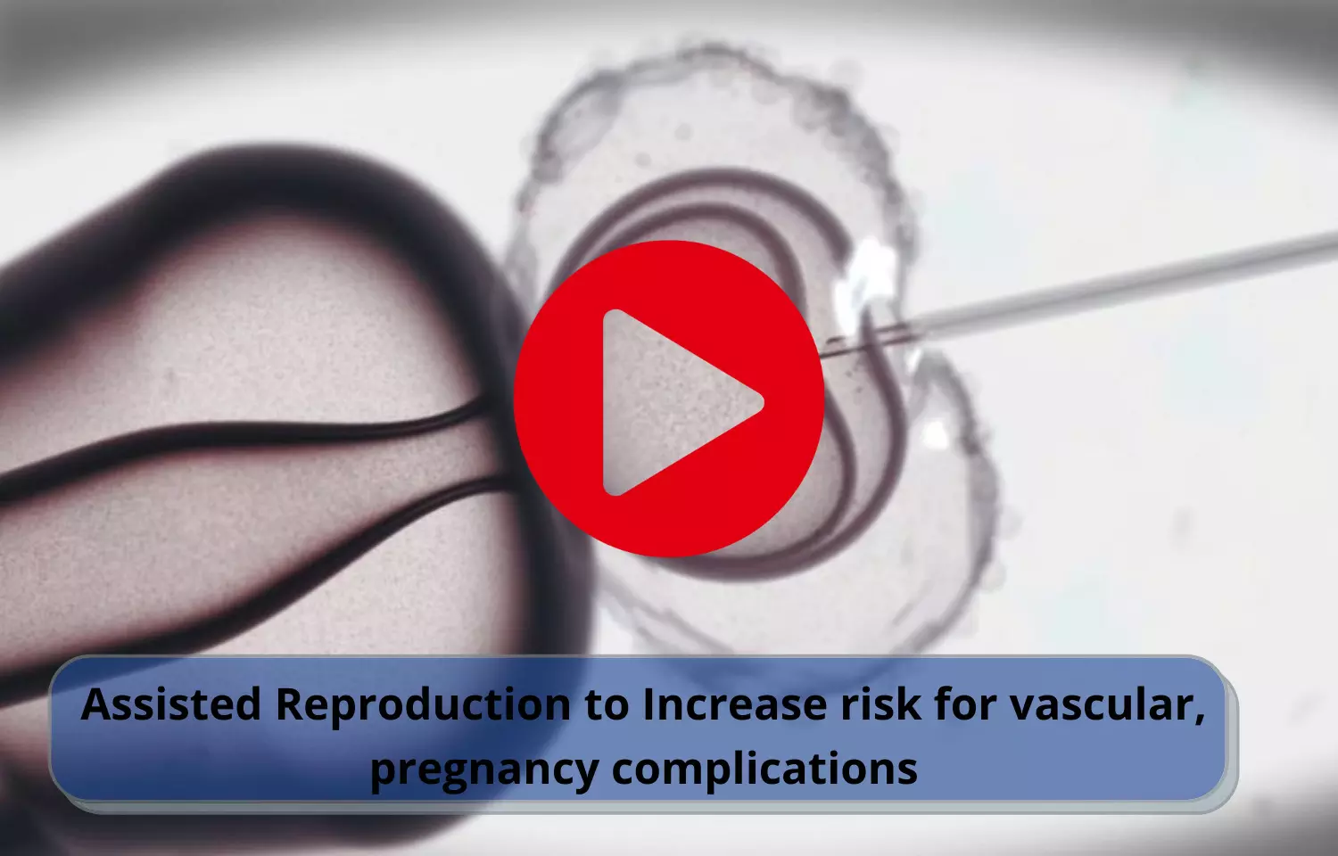 Assisted Reproduction to Increase vascular and pregnancy complications