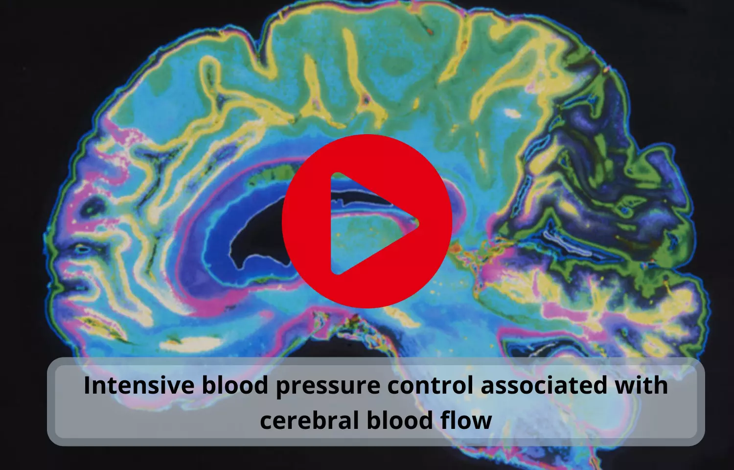 Intensive blood pressure control linked to cerebral blood flow