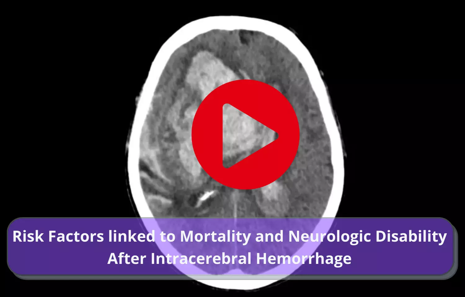 Risk Factors for Mortality and Neurologic Disability After Intracerebral Hemorrhage