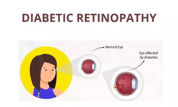 Planning to Get Diabetic Retinopathy Treatment? Here is Everything You Need to Know