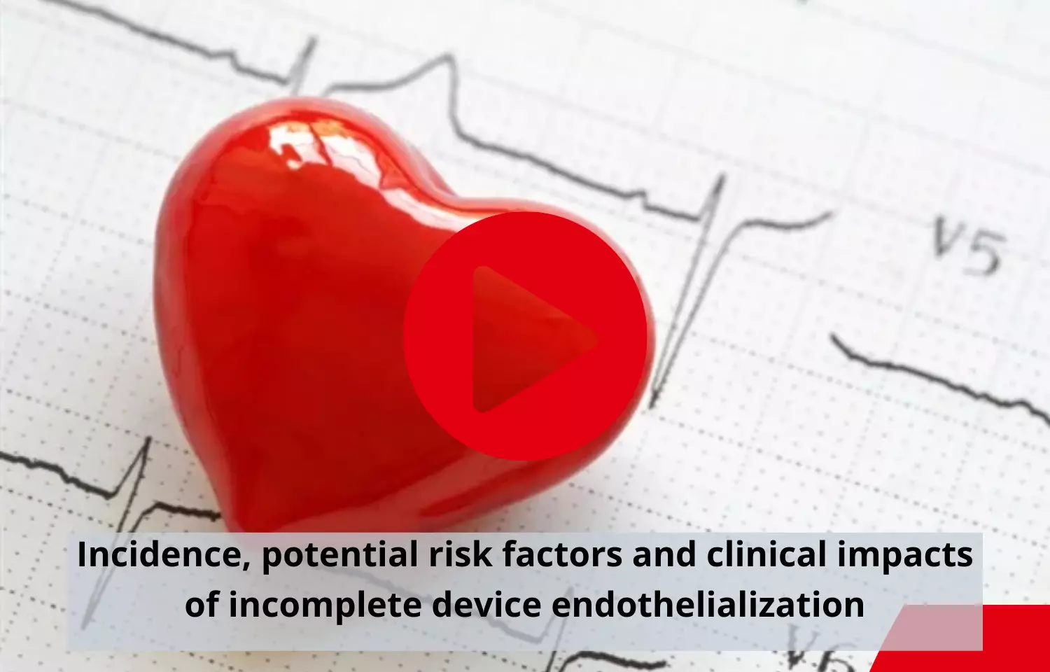 Incidence, potential risk factors and clinical impacts of incomplete device endothelialization