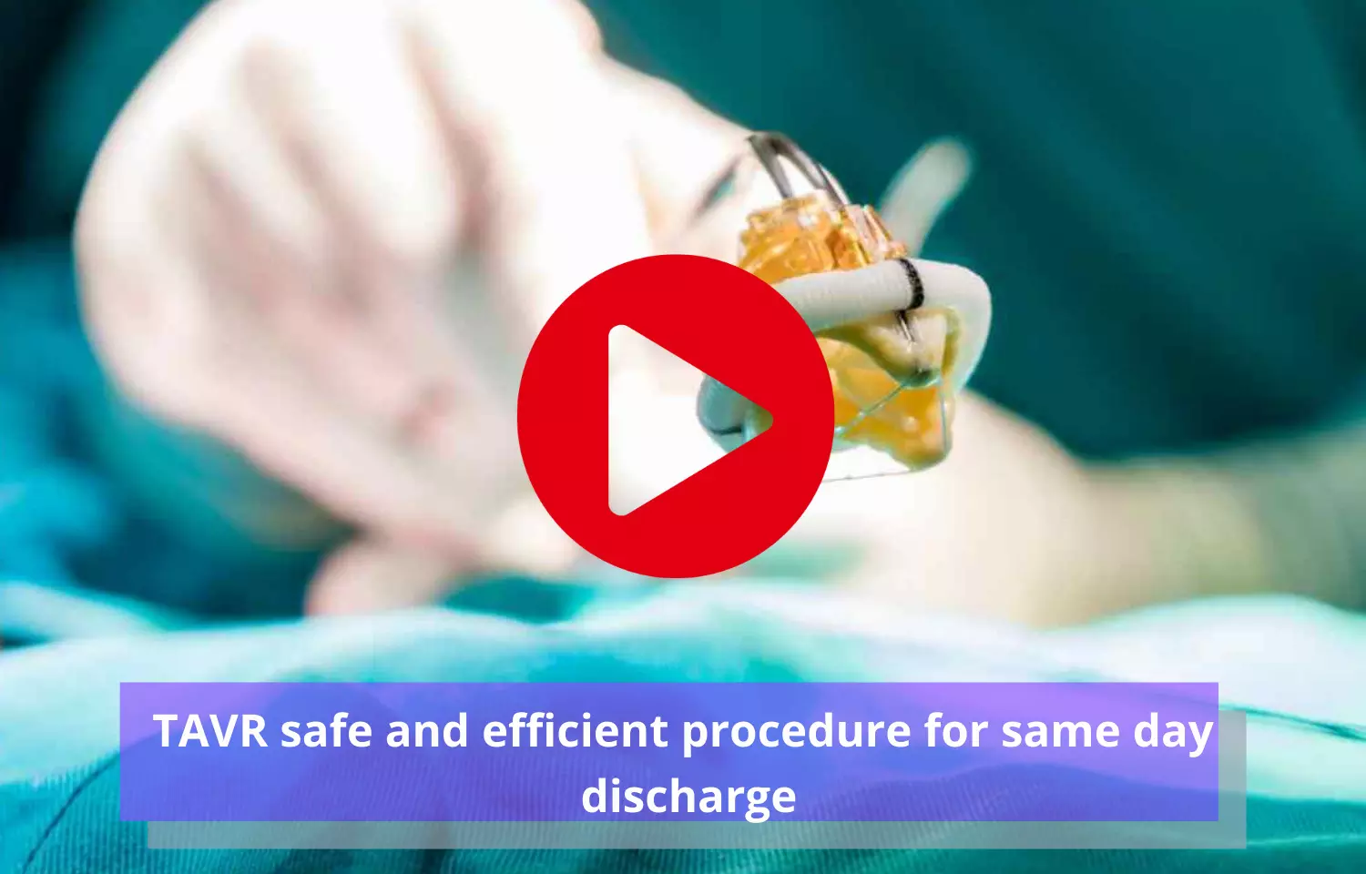 TAVR safe and efficient procedure for same day discharge