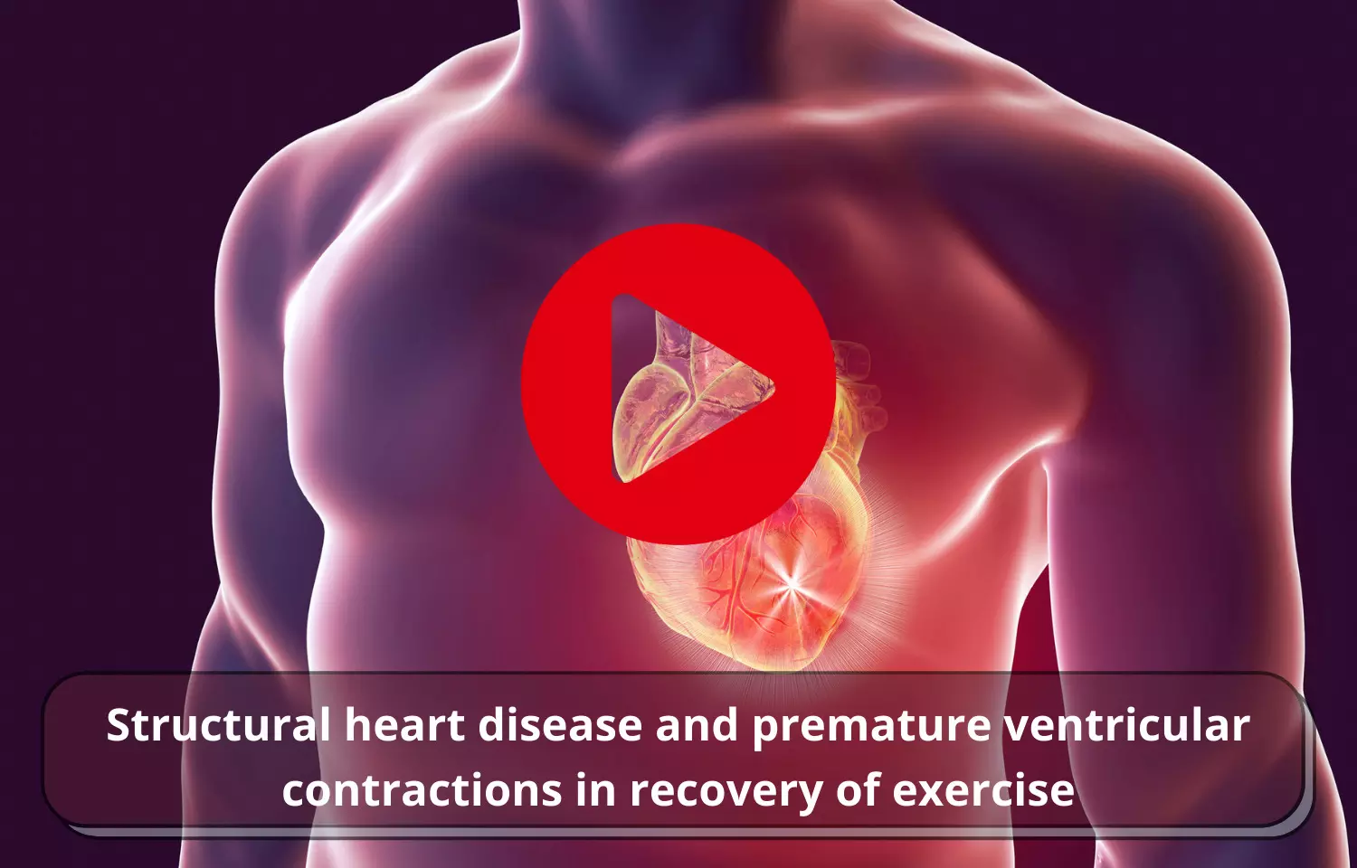 Structural heart disease and premature ventricular contractions in recovery of exercise