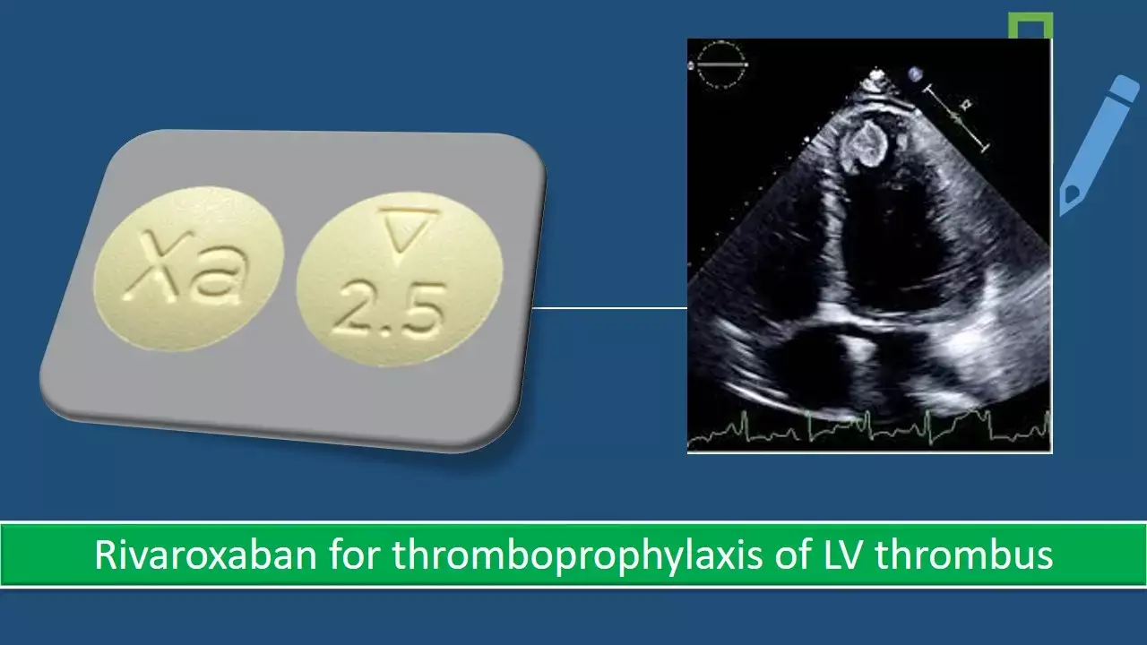 Rivaroxaban helps in preventing LV thrombus formation in MI patients: JACC  study