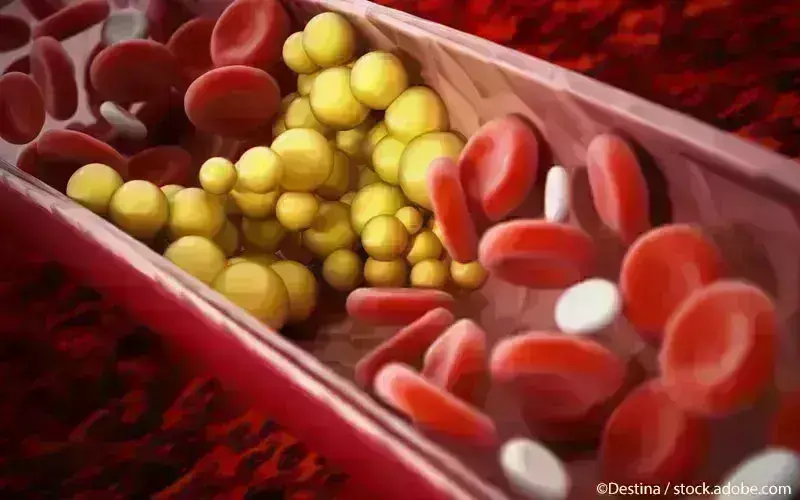 Tirzepatide may reduce CVD Risk in Non-Diabetic Overweight Patients