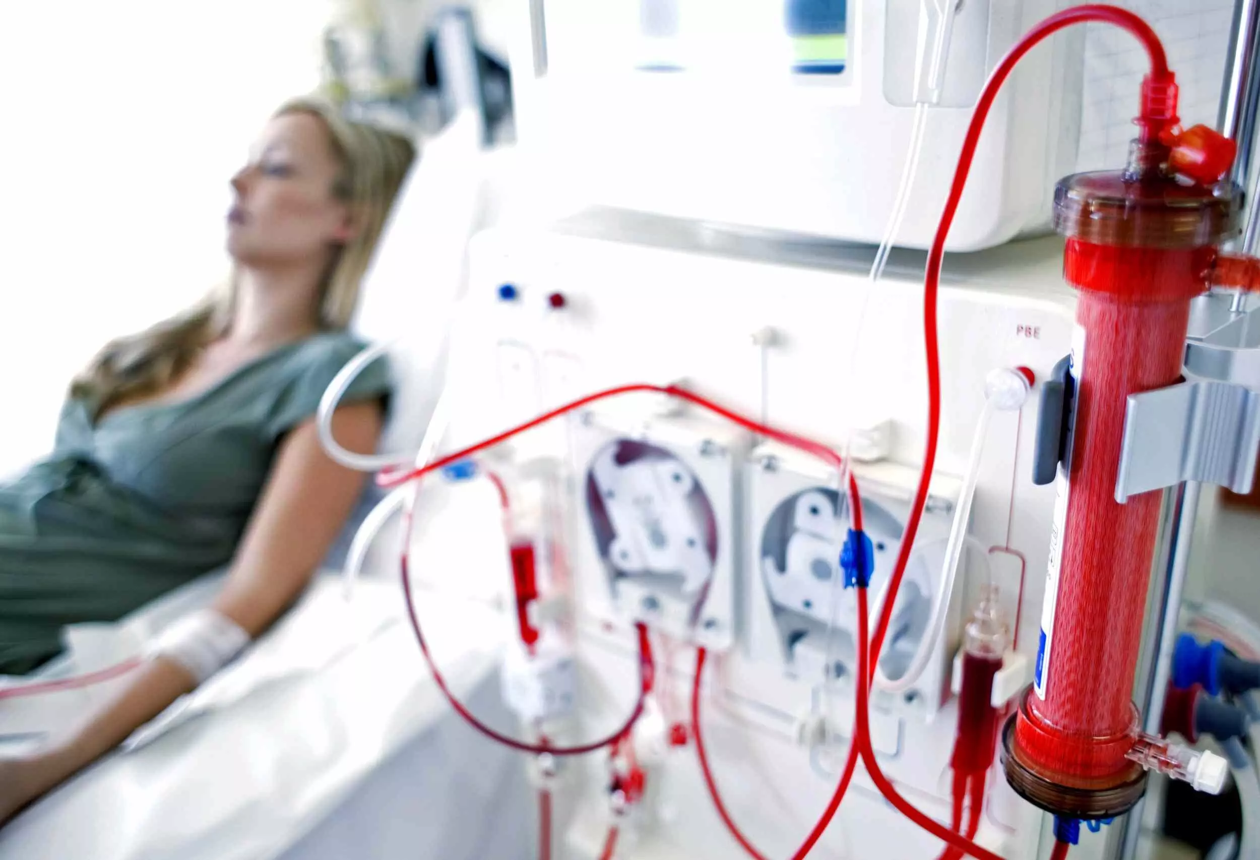 Daprodustat an effective alternative treatment for anemia in incident dialysis patients: JAMA