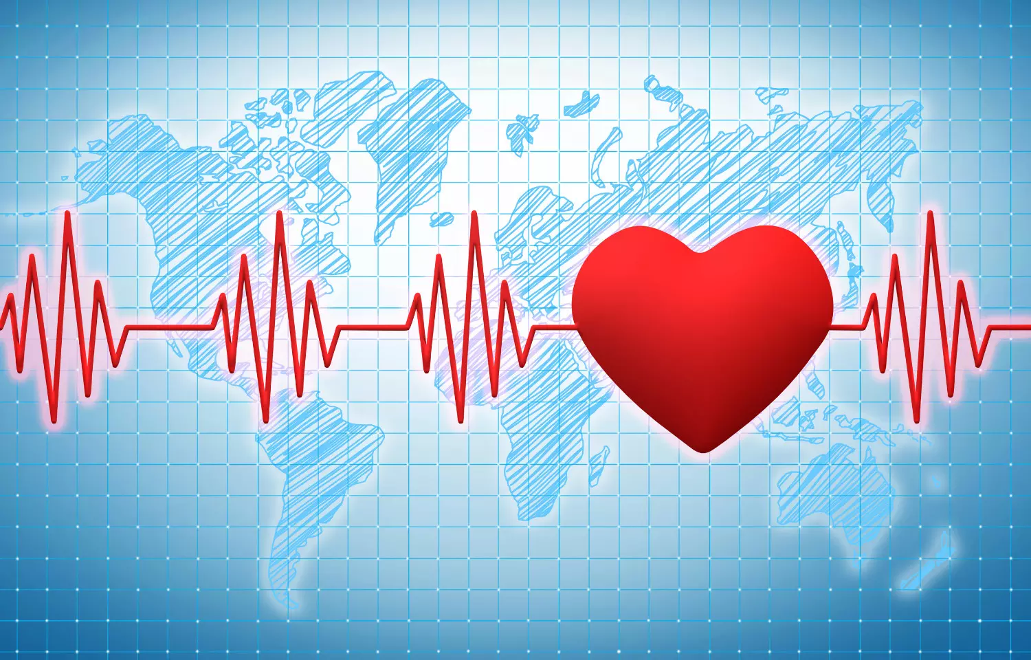 Implantable heart monitor doesnt benefit heart attack survivors overall