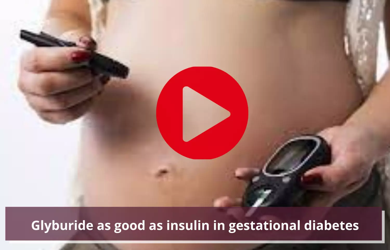 Journal Club - Glyburide as good as insulin in gestational diabetes