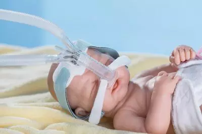 CPAP preferred respiratory support after extubation in critically ill children: JAMA