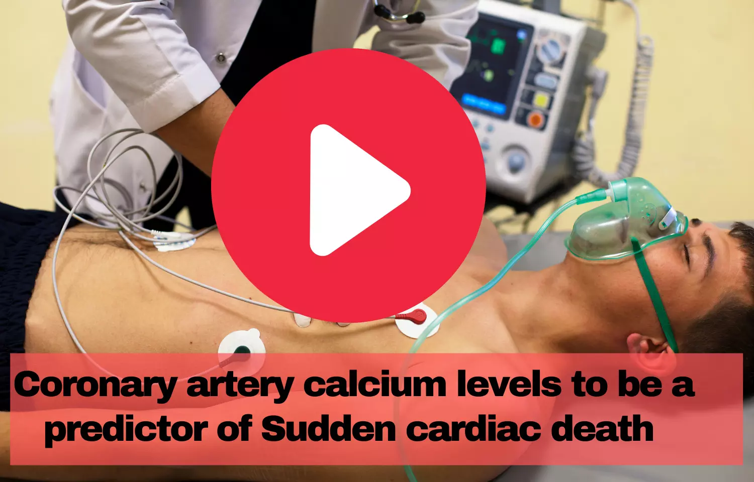 Journal Club- Coronary artery calcium levels to be a predictor of sudden cardiac death