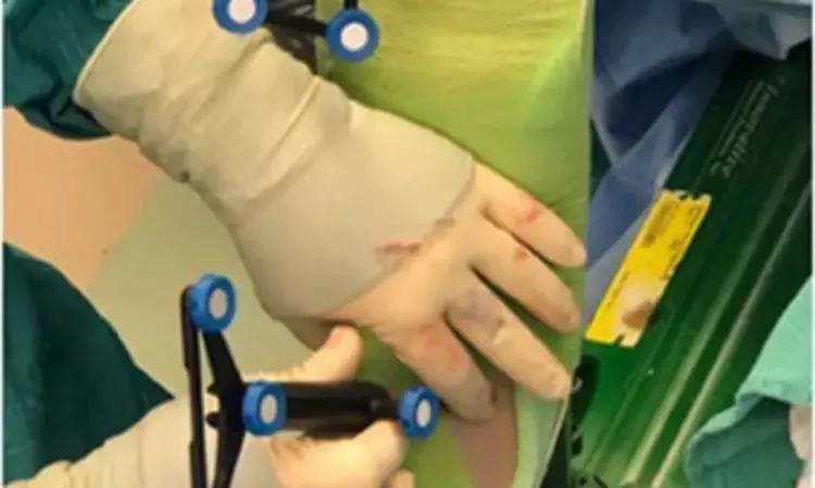 Imageless Robotic Knee Arthroplasty: Novel surgical technique