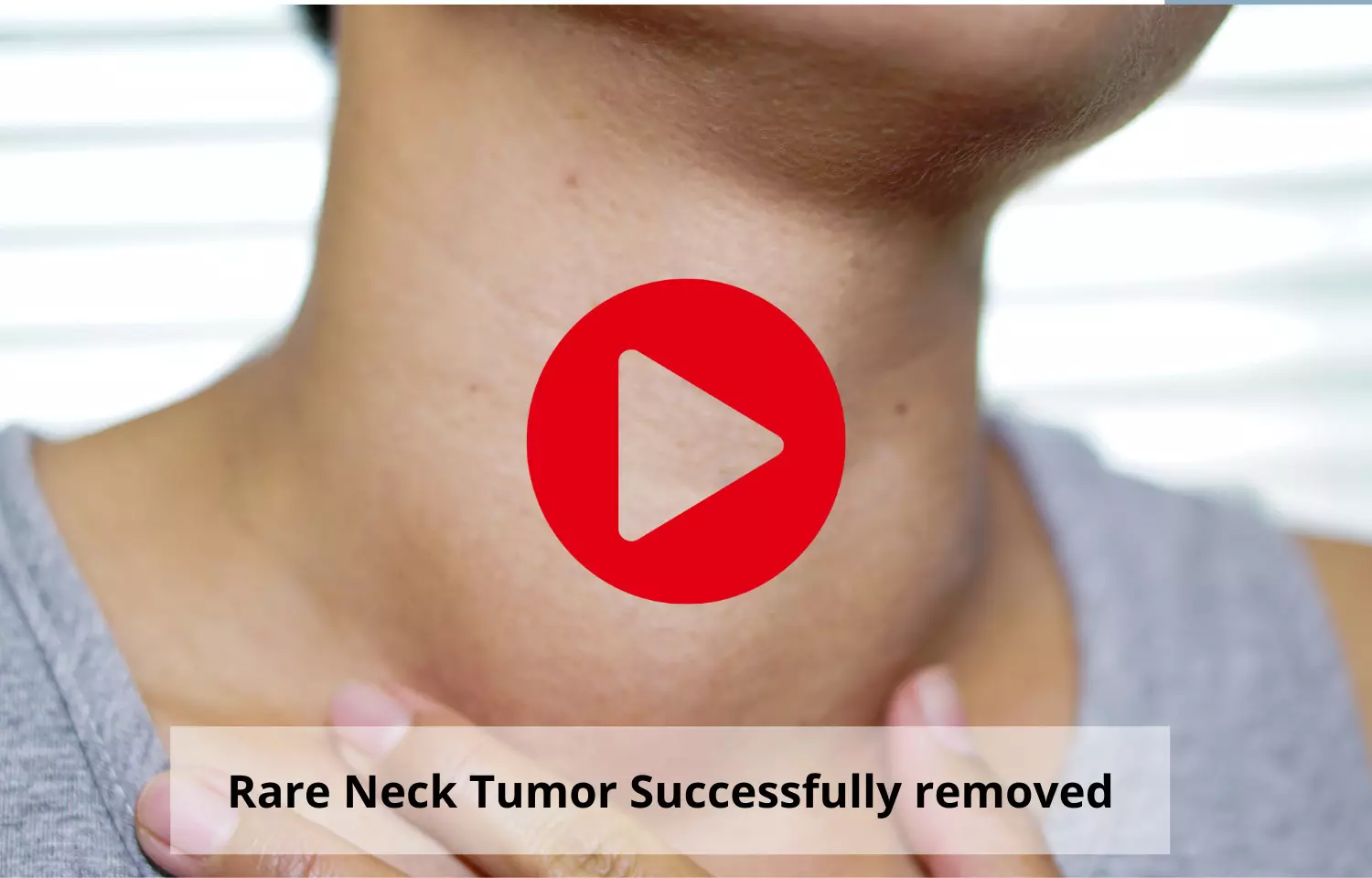 Rare neck tumor successfully removed at Sir Ganga Ram Hospital