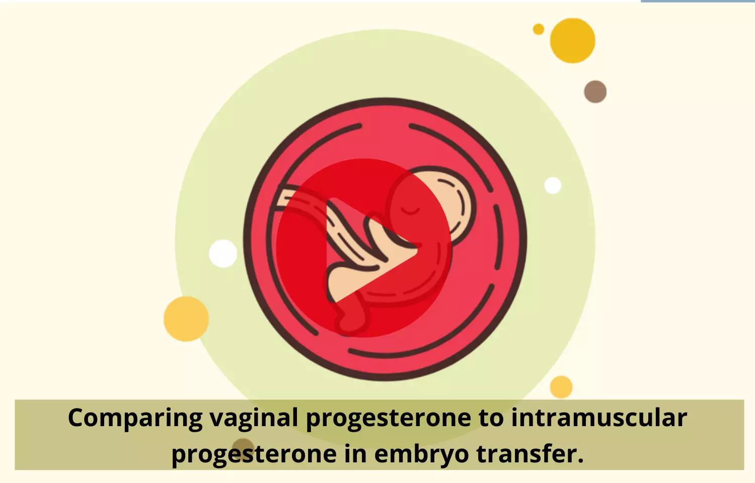 Comparing vaginal progesterone to intramuscular progesterone in embryo transfer.