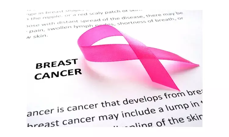Senitel node biopsy not a reliable way to diagnose breast cancer
