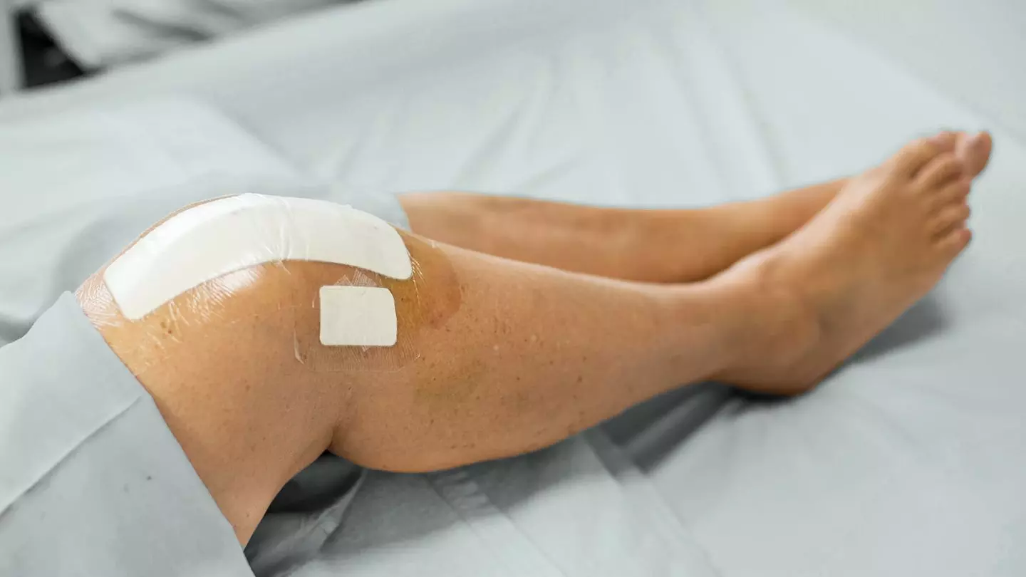 Synovial calprotectin accurately predicts knee Periprosthetic joint infection
