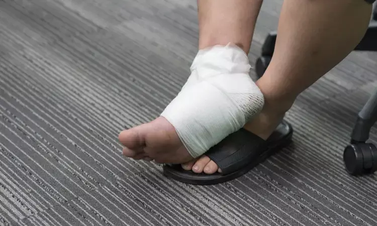 Complex Foot Infection can be treated With Surgical Debridement and Antibiotic Loaded Calcium Sulfate: study