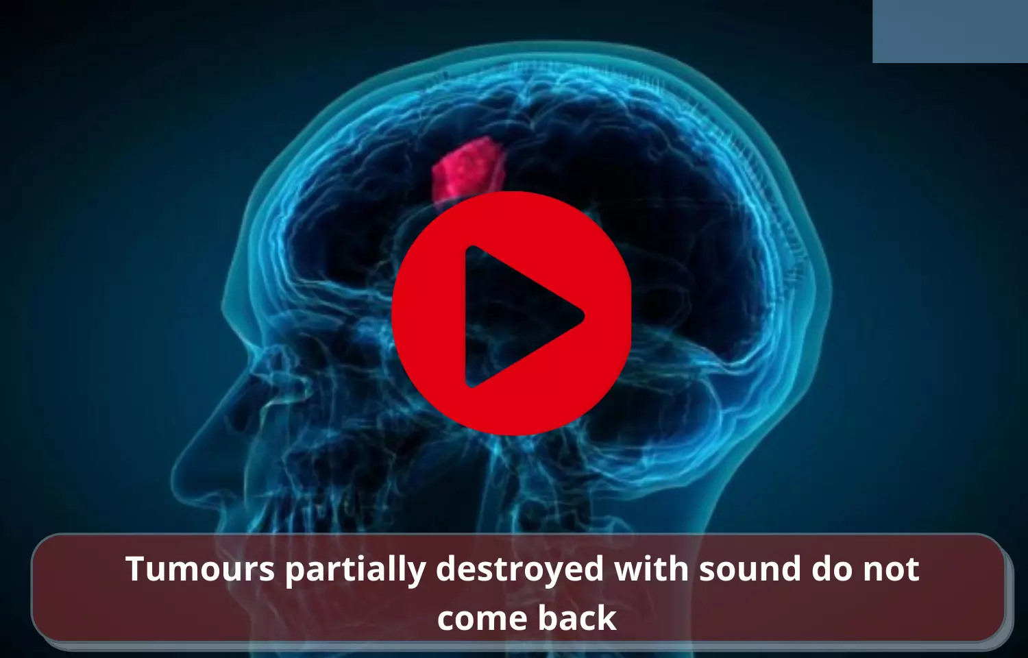 Tumours partially destroyed with sound do not come back