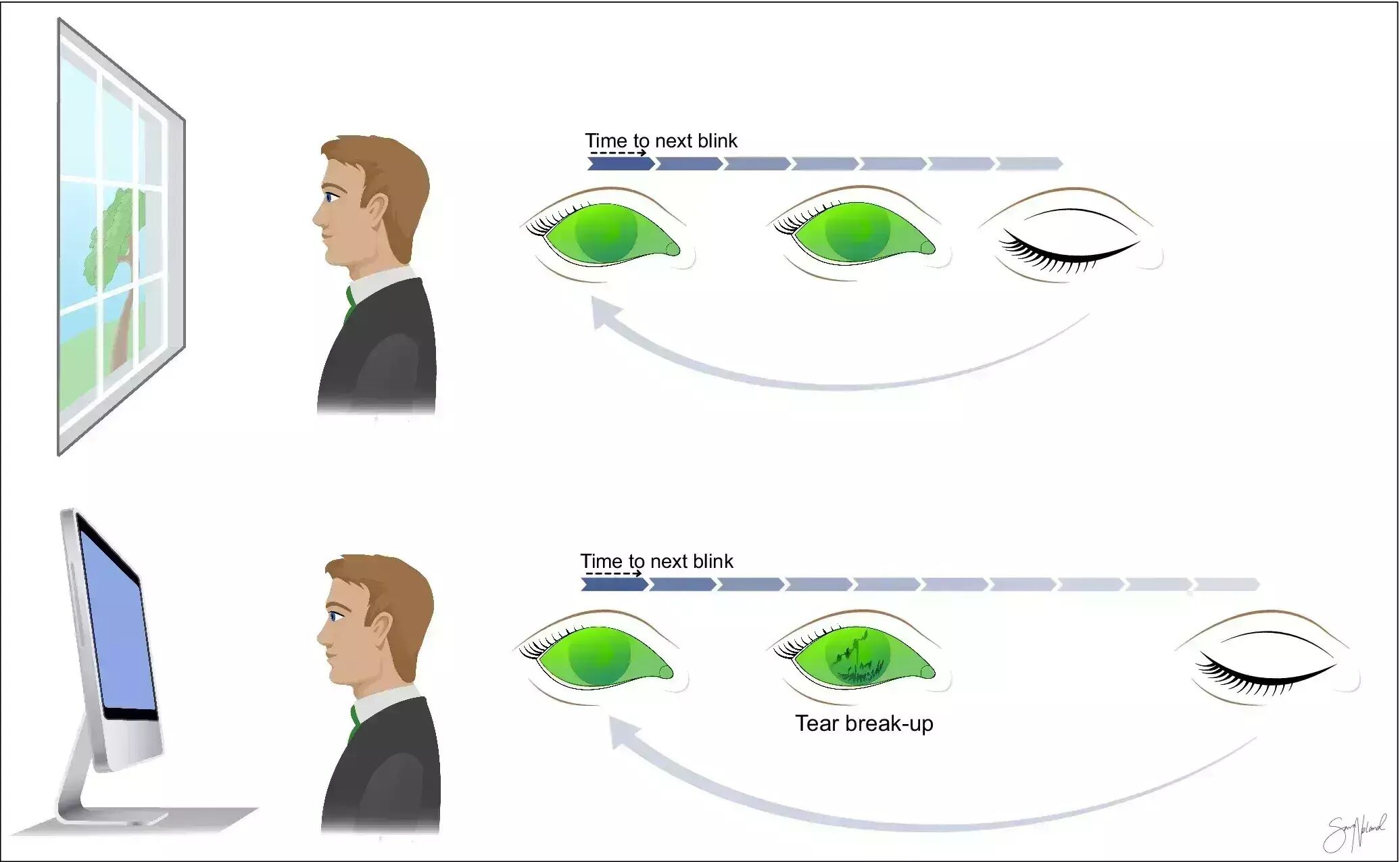 Visual Display Terminal May Induce Dry Eye Disease Through Both Direct