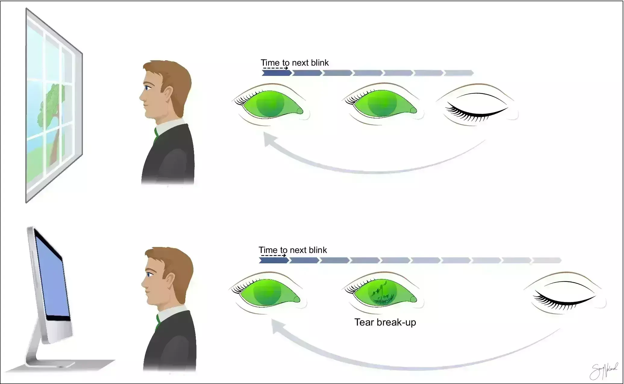 Visual Display Terminal may induce Dry Eye Disease through both direct and indirect routes