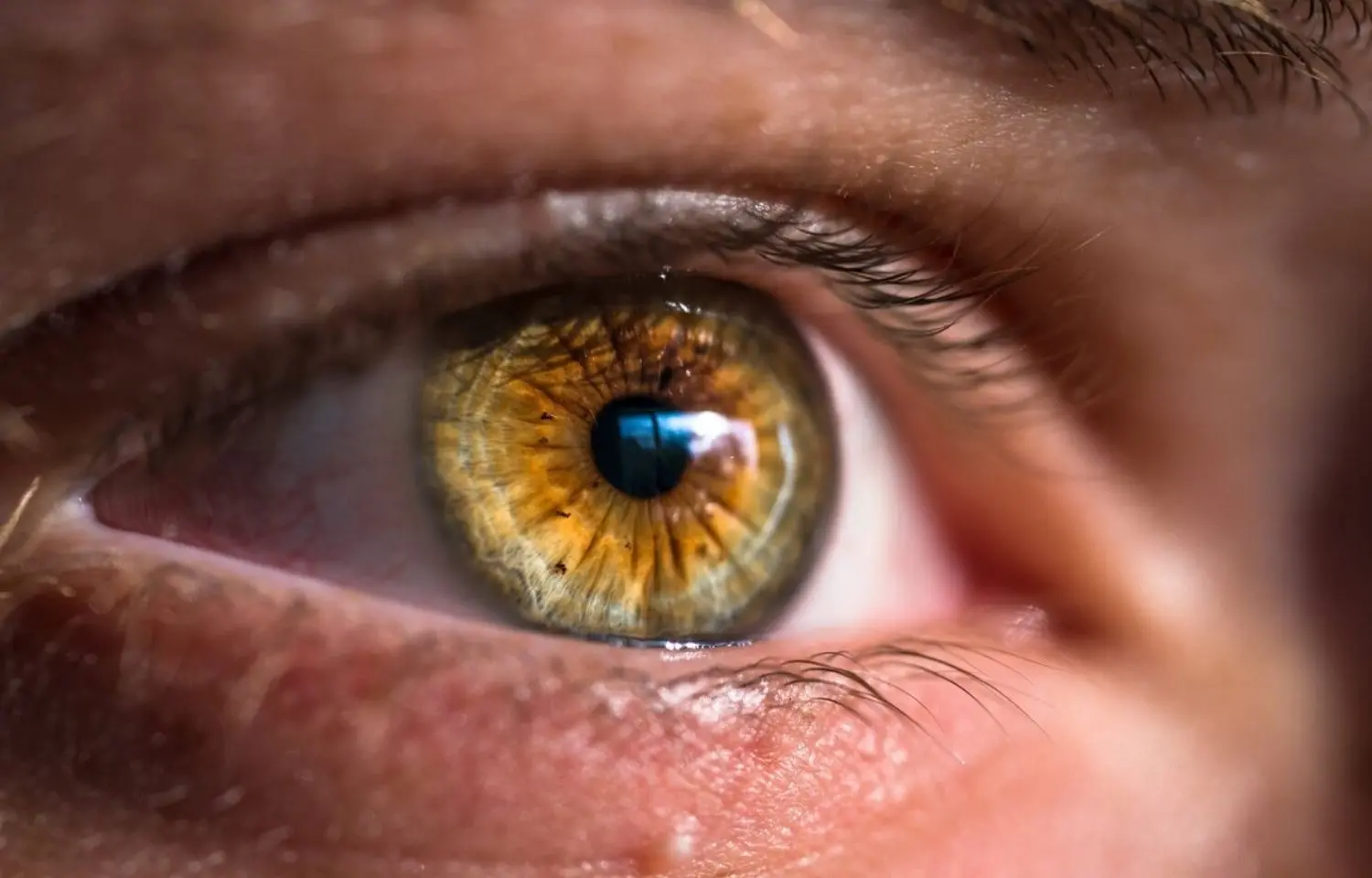 Can retinal age gap predict future risk of Parkinsons disease?