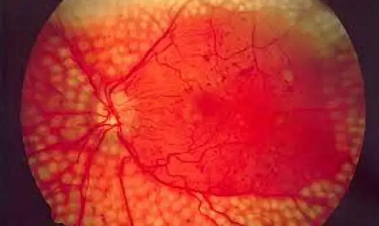 Aspirin or dipyridamole use reduces risk of retinopathy in diabetics: study