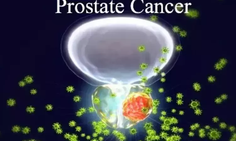 Less prostate cancer screening reduces overdiagnosis but may miss aggressive cases