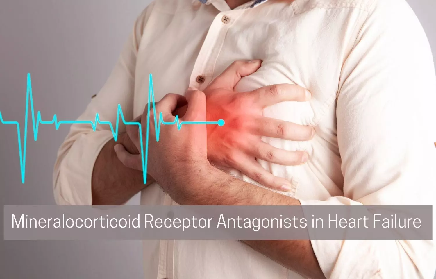 Mineralocorticoid Receptor Antagonists offer great economic value in HF patients: AHA/ACC/HFSA 2022.