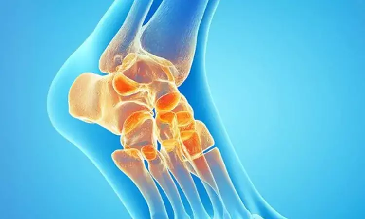 Intra-Articular Sodium Hyaluronate Injection may improve pain and function in Ankle Osteoarthritis