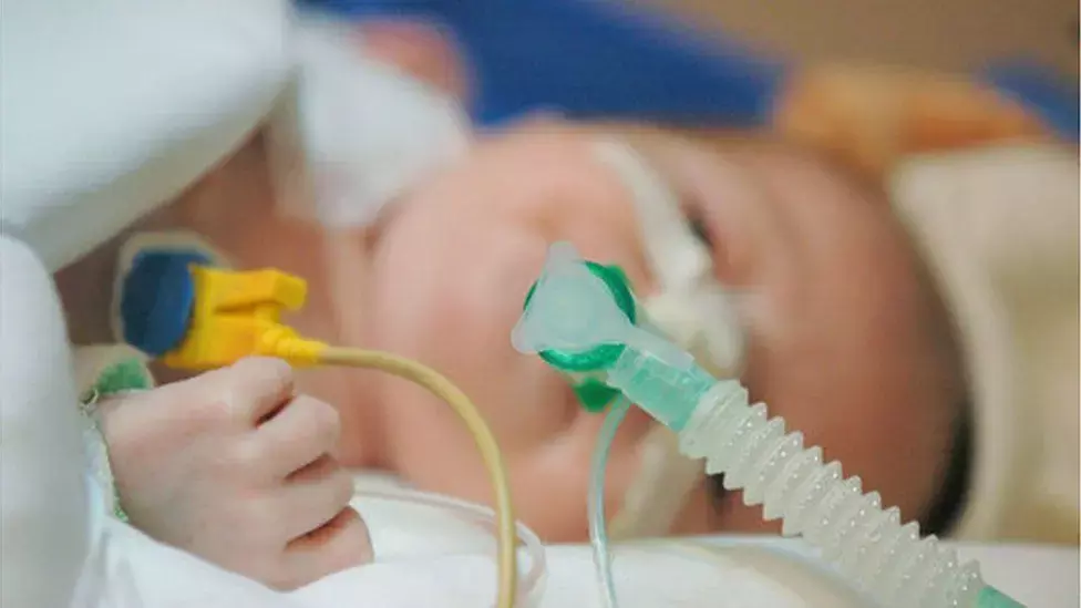 Prophylactic Oropharyngeal Surfactant at birth fails to reduce Intubation Rates among preterm newborns