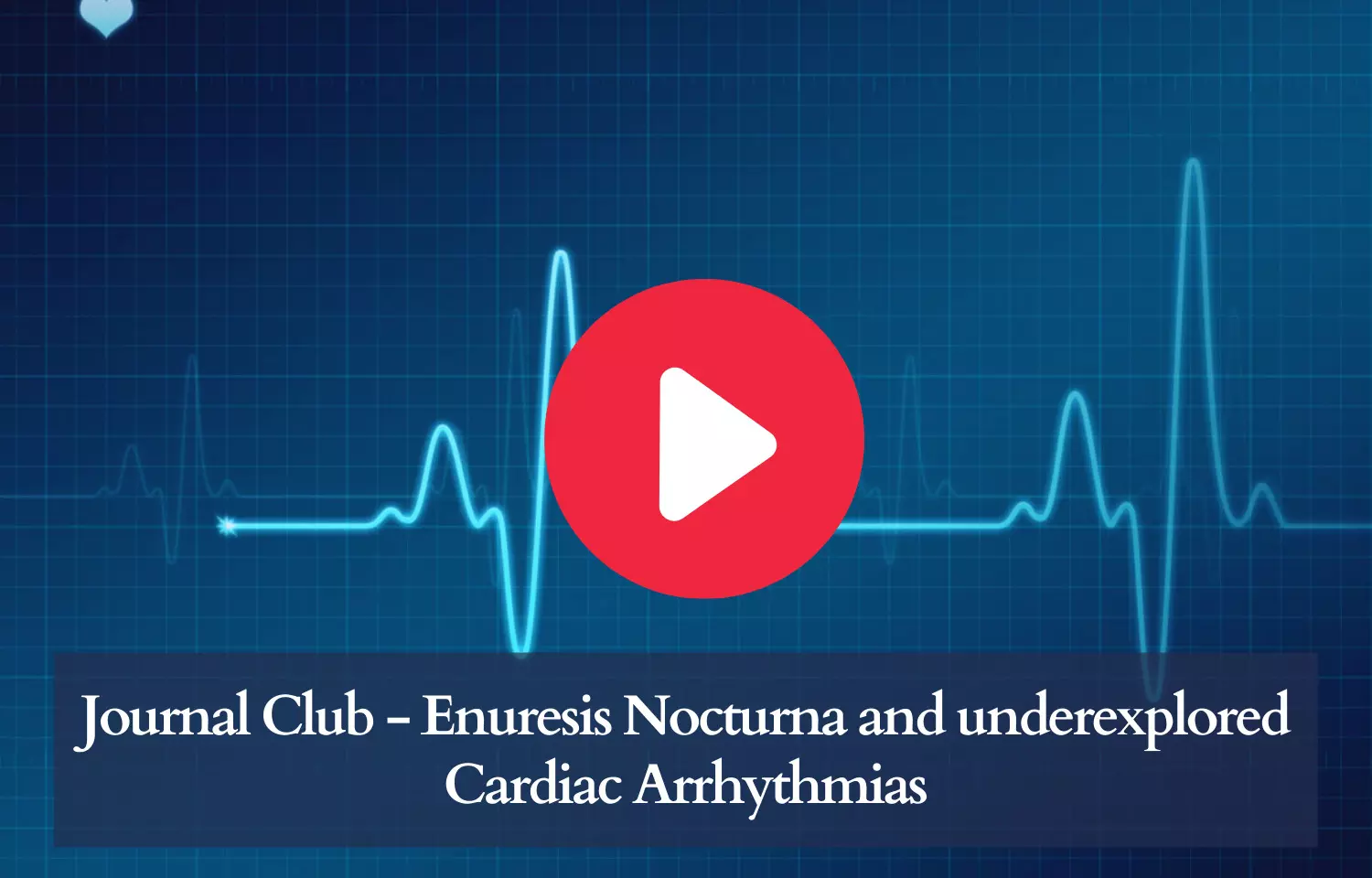 Journal Club - Enuresis Nocturna connected to underexplored Cardiac Arrhythmias