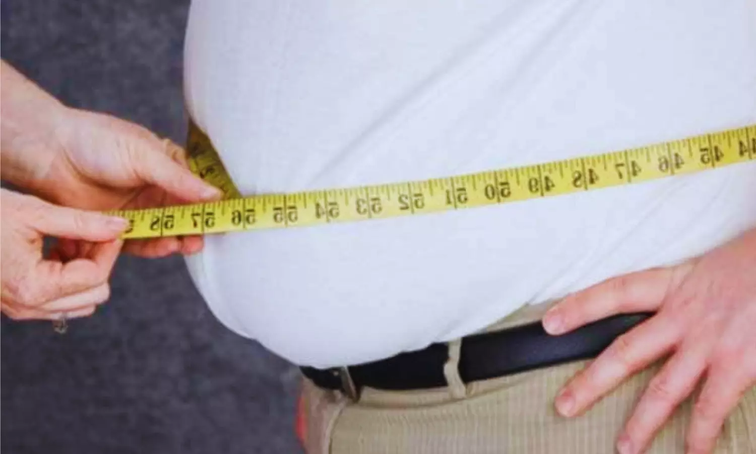 Obesity causes cancer and is major determinant of disability and death, warns new WHO report