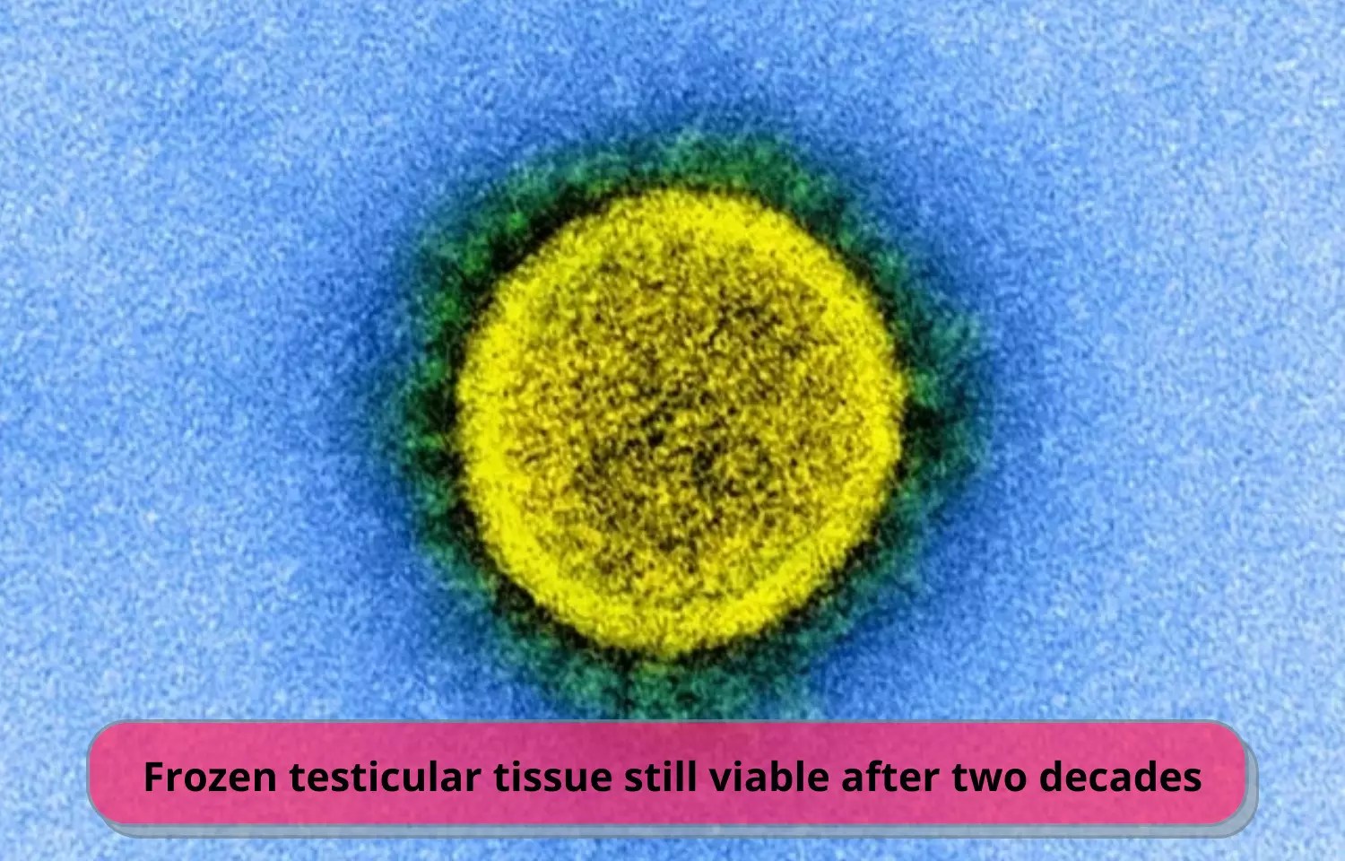 Journal Club - Frozen testicular tissue still viable after two decades