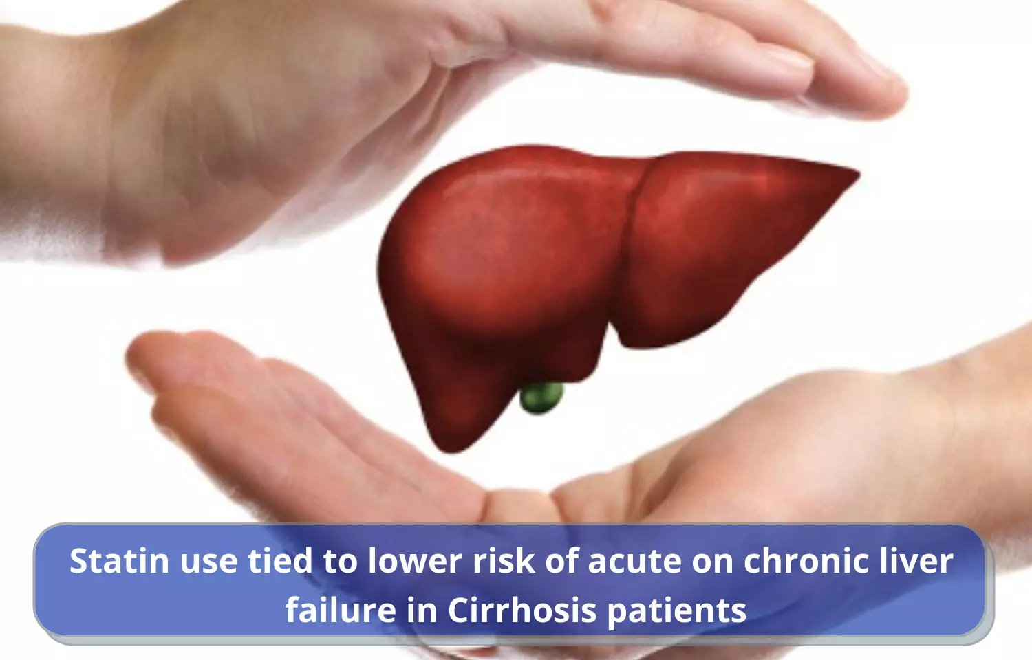 Journal Club - Statin use tied to lower risk of acute on chronic liver failure in Cirrhosis patients