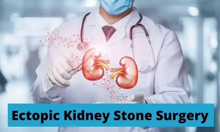 In rare surgery, Apollo doctors remove Ectopic kidney stone