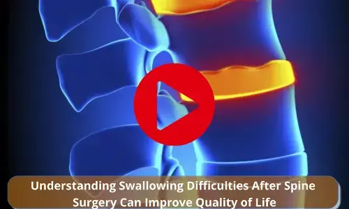 Understanding Swallowing Difficulties After Spine Surgery Can Improve Quality of Life