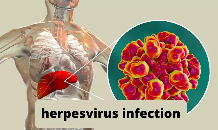 Herpes virus infections linked to development of diabetes among infected individuals